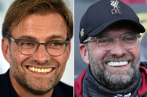 jurgen klopp teeth before and after